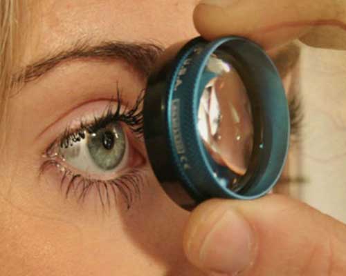 Glaucoma